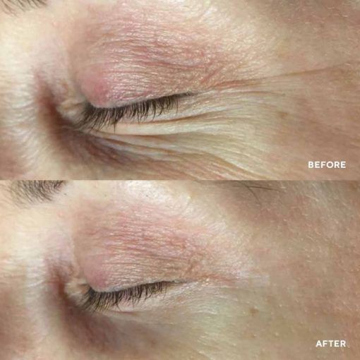 PolyPeptide Collagel + Mask for eyes &ndash; Патчі для зони навколо очей tk49 фото