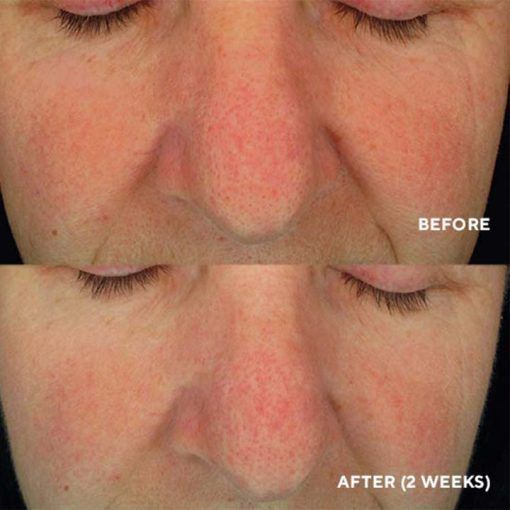 Soothing Serum &ndash; Заспокійлива сироватка tk706 фото